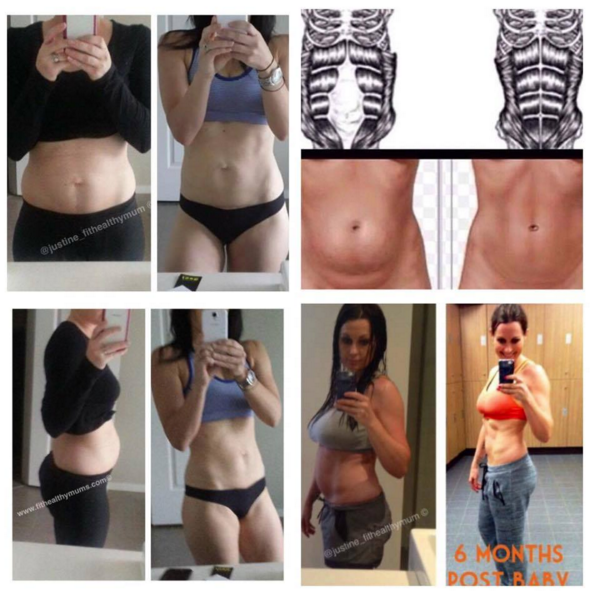 Do You Have Ab Separation? – Real Fitness for Mums